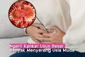 Ngeri! Kanker Usus Besar Marak di Kalangan Gen Z – Ini Gejalanya