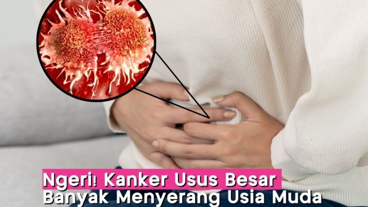 Ngeri! Kanker Usus Besar Marak di Kalangan Gen Z – Ini Gejalanya