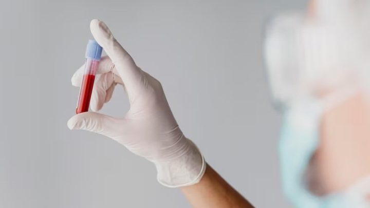 Ini Golongan Darah yang Berisiko Tinggi Terkena Stroke Dini