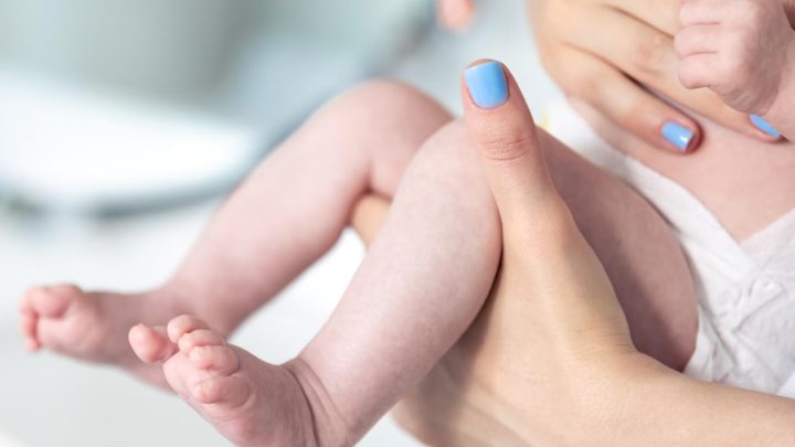 Anak Punya Benjolan di Paha? Hati-Hati Tanda Hernia